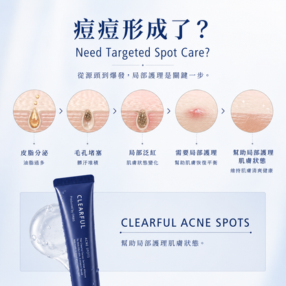 ORBIS CLEARFUL Acne Spots 痘痘局部护理凝胶 局部护理说明